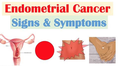 signs of endometriosis cancer